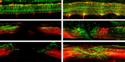 In Animal Study, Nanobots Repair Spinal Cords