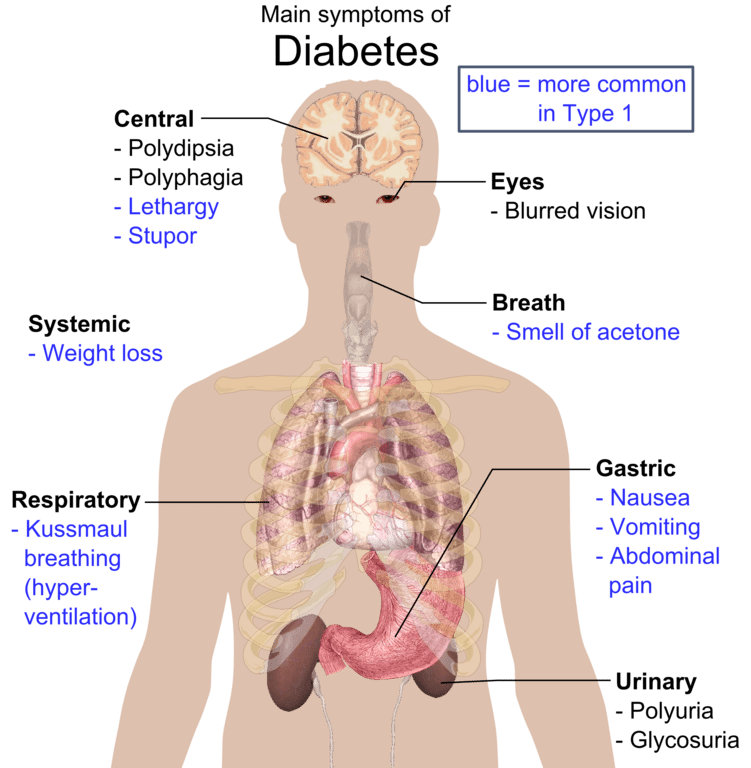Main_symptoms_of_diabetes
