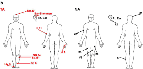 Figure 1B