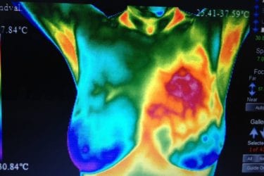 Thermography