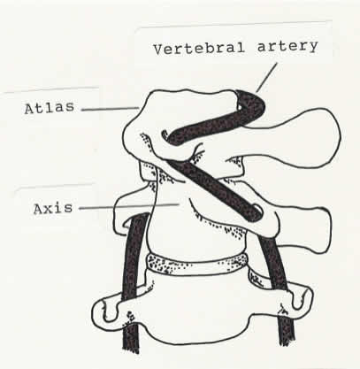 Forced rotation of the atlas on the axis past 45 or 50 degrees stretches the vertebral arteries.