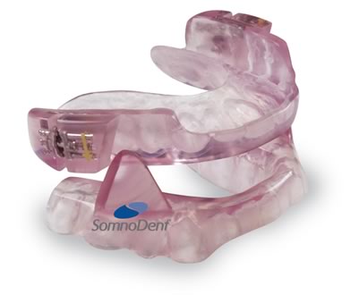 somnodent-oral-appliance