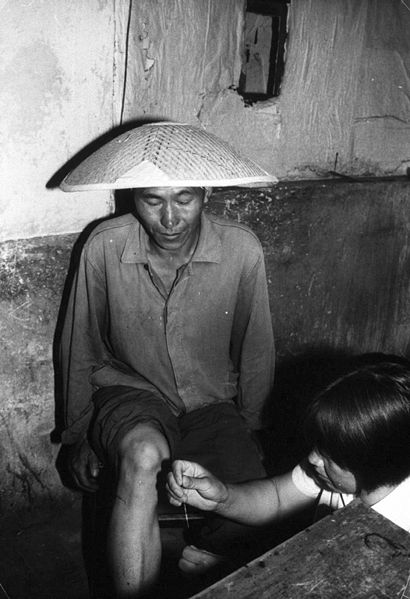 410px-Chinese_barefoot_doctor_performing_acupuncture