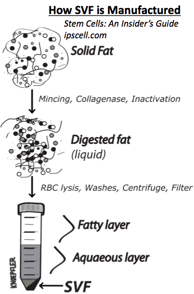  Stromal vascular fraction, an extract of cleaned, centrifuged stem cells derived from body fat.