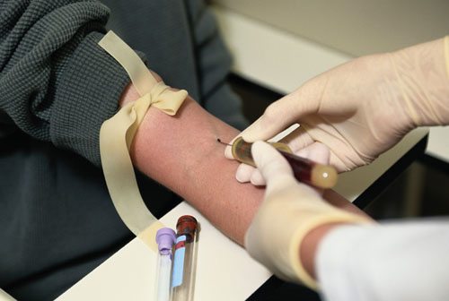 Could a blood draw be all you need to diagnose cancer and identify the best treatment for it? Not so fast...