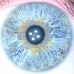 Iridology