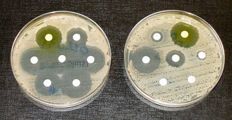 Antibiotic sensitive (left) and resistant (right) bacterial colonies. They probably shouldn't be that close together.