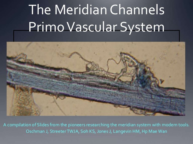 Is this a PVS structure or something else?