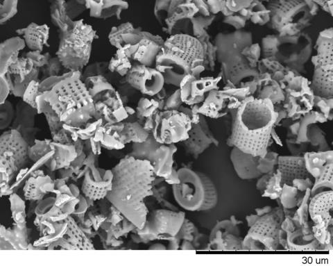 Would you eat this? It might look like a crunchy new breakfast cereal, but it's a close-up of diatomaceous earth, the fossilized microscopic skeletons of diatoms.