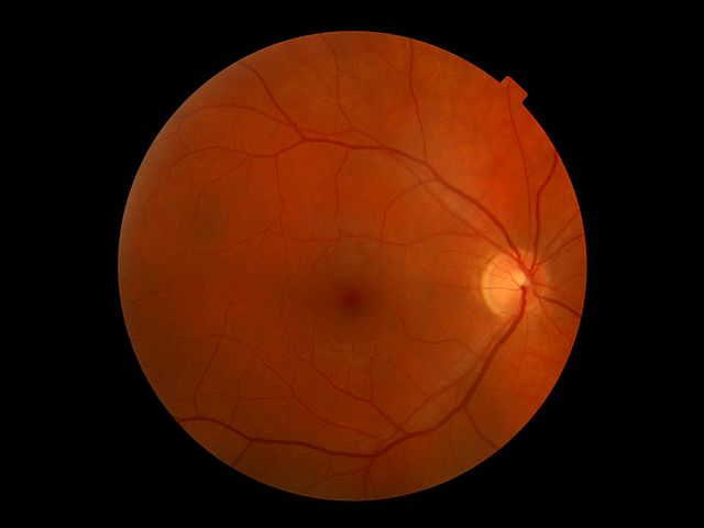Picture of the human retina; the bright spot on the right is the blind spot where the optic nerve leaves the eye.