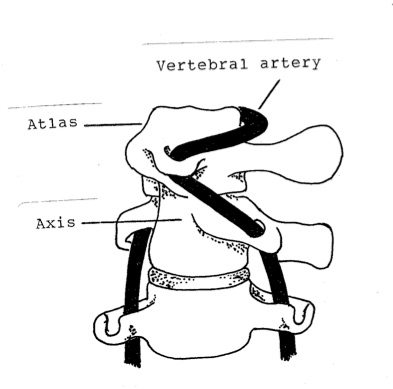 Forced passive rotation of the atlas on the axis past 45 or 50 degrees stretches the vertebral artery. Normally, during active cervical rotation, all of the cervical vertebrae move together, a little movement in each joint, allowing about 80 degrees of rotation right and left. The atlantoaxial joint, where there is no intervertebral disc, is capable of about 50 degrees of independent rotation right and left, allowing excessive rotation during upper cervical rotatory manipulative techniques.