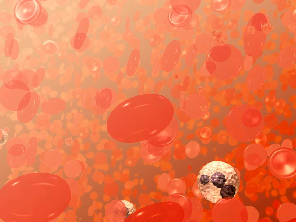 A field of blood cells. The bi-concave disks are red blood cells or erythrocytes. The white cell with the dark purplish, multi-lobed nucleus is a neutrophil, a type of white blood cell or leukocyte. The smaller spikey objects are platelets. (photo and text from NCI Visuals Online Library image 3696, created by Donald Bliss.