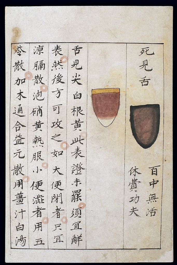 Traditional Chinese Medicine Tongue Chart