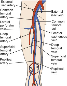 Anatomy of the iliac-femoral artery/vein confluence, where the external iliac artery/vein turn into the femoral artery/vein.