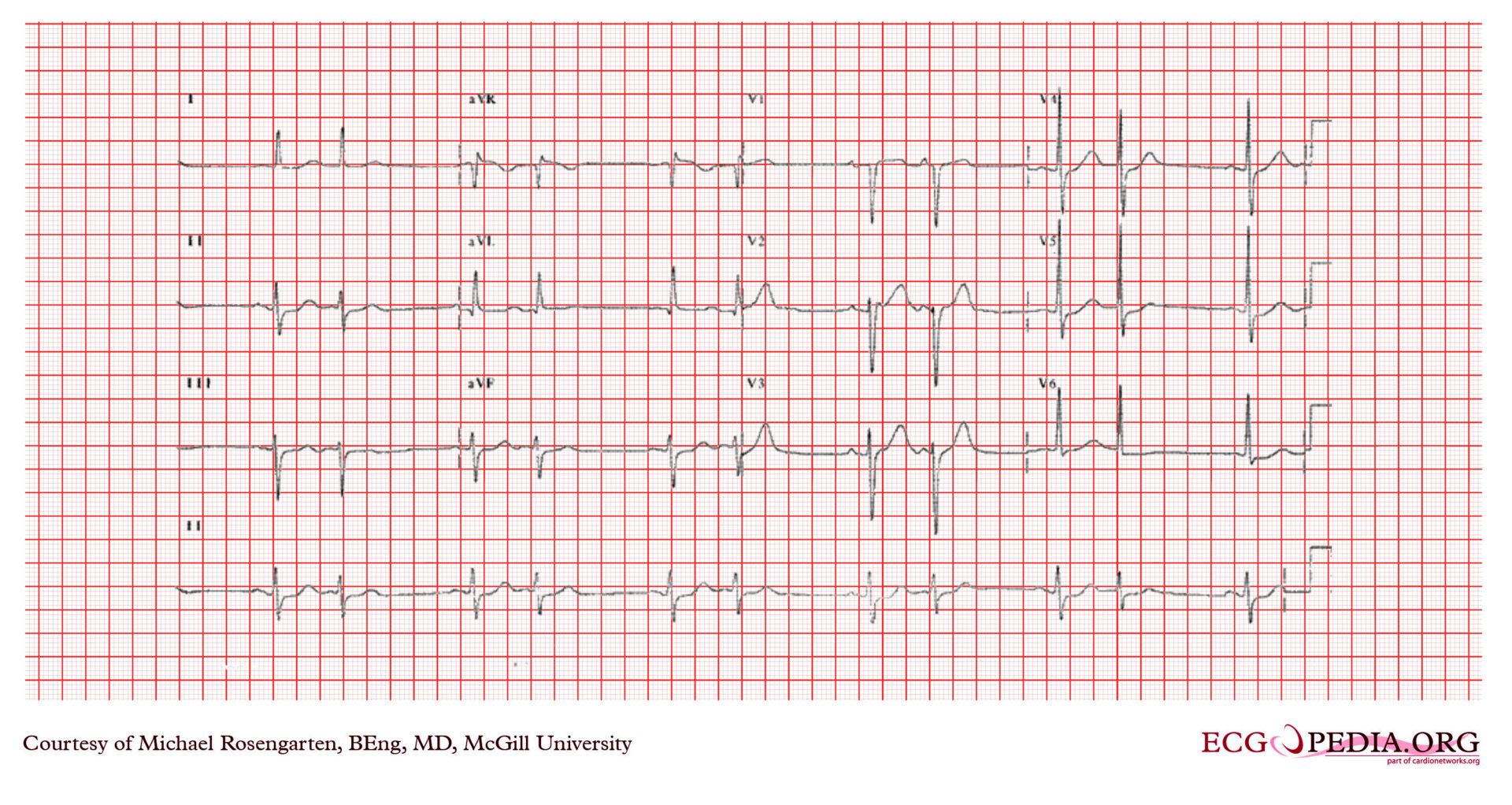 Pulse Diagnostics | Science-Based Medicine