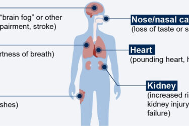 An illustrated human body diagram showing the effects of COVID-19 on various organs. Key areas labeled include the brain (cognitive impairment, stroke), lungs (cough, shortness of breath), skin (bruising, rashes), nose (loss of taste or smell), heart (pounding heart, heart failure), and kidney (increased risk of acute injury and failure).