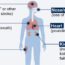 An illustrated human body diagram showing the effects of COVID-19 on various organs. Key areas labeled include the brain (cognitive impairment, stroke), lungs (cough, shortness of breath), skin (bruising, rashes), nose (loss of taste or smell), heart (pounding heart, heart failure), and kidney (increased risk of acute injury and failure).