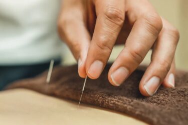 Close-up of a hand performing acupuncture, carefully inserting thin needles into a person's skin. The background is softly blurred, emphasizing the focus on the acupuncture practice.