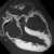 Black and white cross-sectional medical image (MRI or CT scan) showing detailed structures of the human heart, including chambers and surrounding tissues, viewed from above.