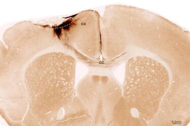 A stained cross-section of a brain shows labeled anatomical regions, including "CX" and "CC," with dark and light regions indicating different tissue densities. A scale bar at the bottom right reads 0.5 mm.