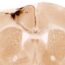 A stained cross-section of a brain shows labeled anatomical regions, including "CX" and "CC," with dark and light regions indicating different tissue densities. A scale bar at the bottom right reads 0.5 mm.