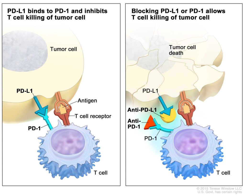 Two panels show how PD-L1 on tumor cells binds to PD-1 on T cells to block immune response, and how anti-PD-L1 or anti-PD-1 drugs block this interaction, allowing T cells to kill tumor cells.