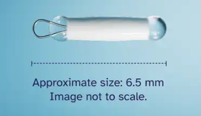 A small, cylindrical medical implant with a metal loop at one end and rounded glass tips, shown above text reading, "Approximate size: 6.5 mm. Image not to scale," on a blue background.