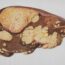A detailed illustration of a human liver with multiple large, irregular yellowish masses indicating severe fatty infiltration or disease, against a plain white background.
