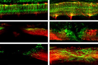 Six microscope images show neural tissue with green and red fluorescent staining. Patterns and intensities vary, highlighting differences in cellular structures or experimental conditions across the three paired rows.