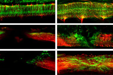 Six microscope images show neural tissue with green and red fluorescent staining. Patterns and intensities vary, highlighting differences in cellular structures or experimental conditions across the three paired rows.