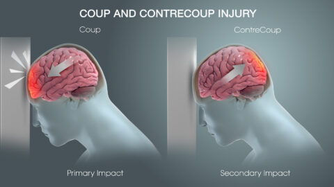 Preventing Traumatic Brain Injury