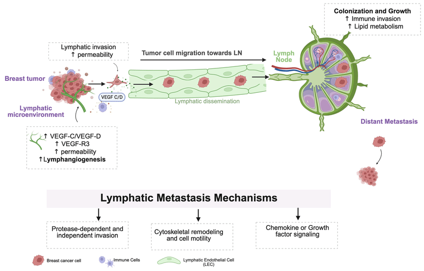 Diagram illustrating how breast tumor cells invade lymphatic vessels, migrate to lymph nodes, and spread to distant sites, with notes on lymphatic invasion, dissemination, and metastasis mechanisms.