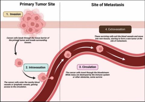 The metastasis hoax?