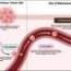 Diagram showing cancer metastasis: At the tumor site, cells invade tissue, then enter blood vessels (intravasation). They travel in the bloodstream (circulation) and exit vessels to form new tumors in tissues (extravasation).