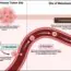 Diagram showing cancer metastasis: At the tumor site, cells invade tissue, then enter blood vessels (intravasation). They travel in the bloodstream (circulation) and exit vessels to form new tumors in tissues (extravasation).