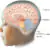 Side profile of a child’s head with a labeled diagram of the brain, showing the forebrain, midbrain, and hindbrain, including the pons, cerebellum, and medulla.