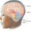 Side profile of a child’s head with a labeled diagram of the brain, showing the forebrain, midbrain, and hindbrain, including the pons, cerebellum, and medulla.